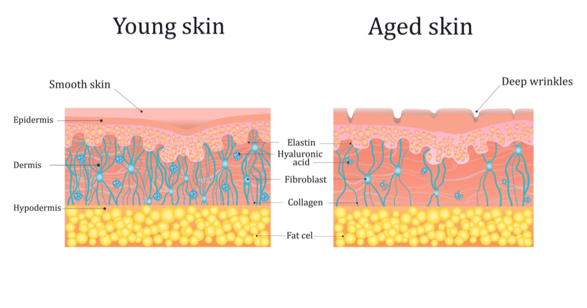 Peau jeune vs. peau âgée